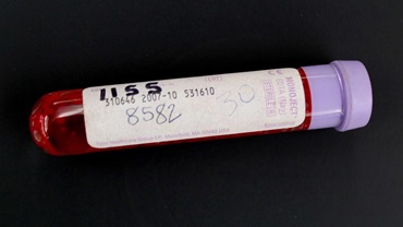 Blood sample in a tube