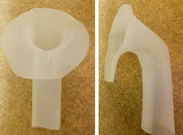 Milk jug tracheostomy tube Meyring