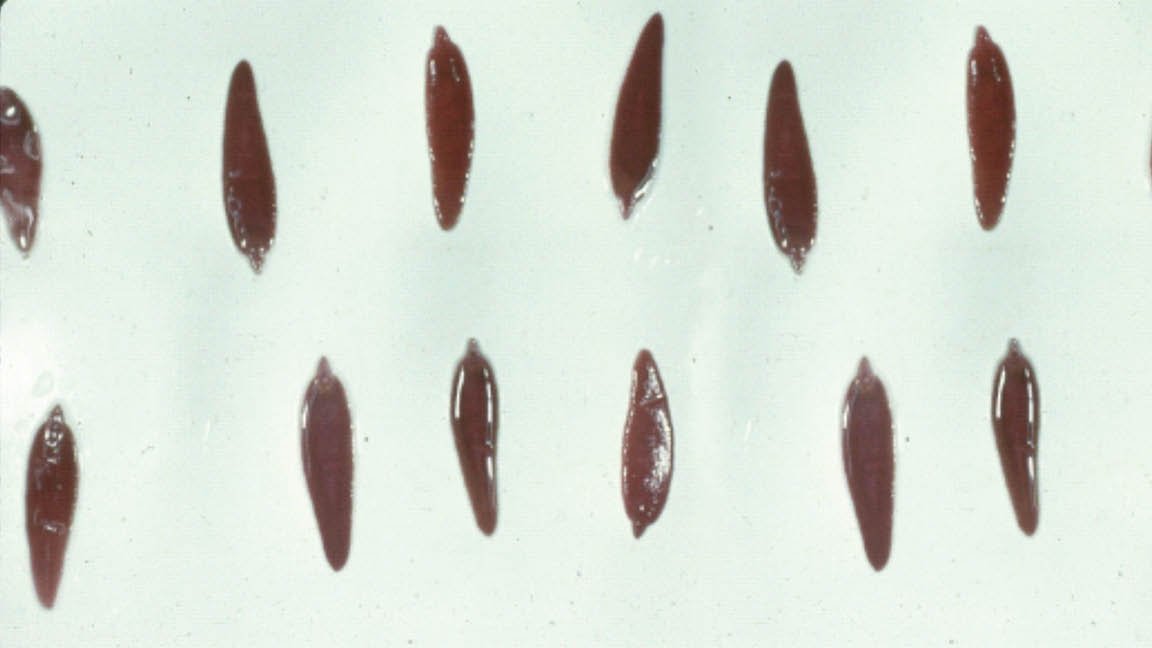 A photo of adult liver flukes. 