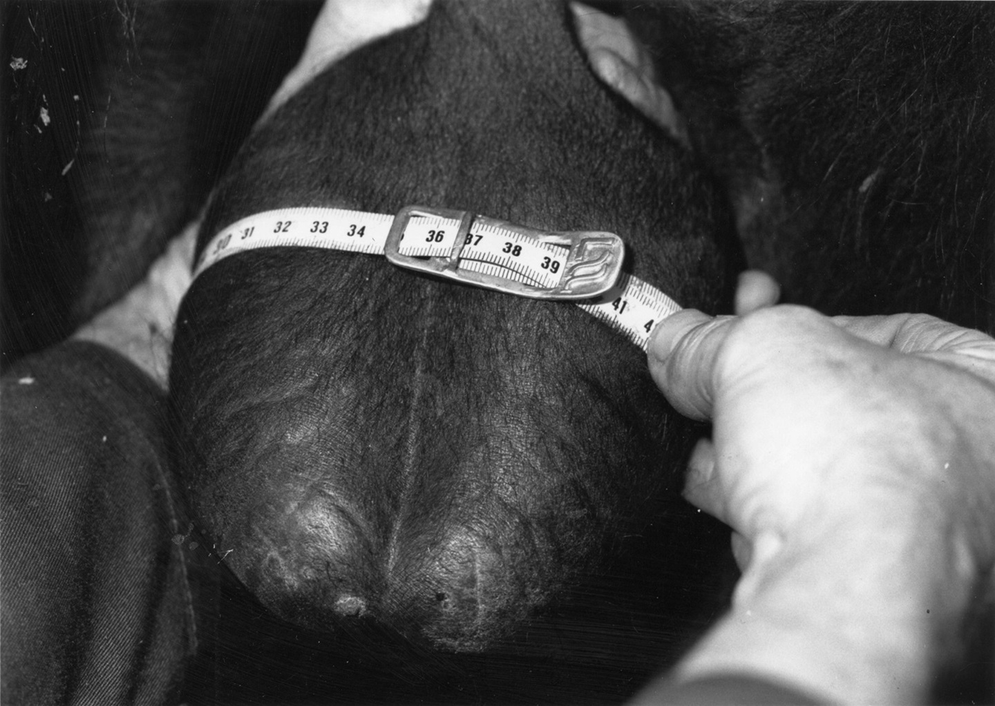 scrotum before frostbite