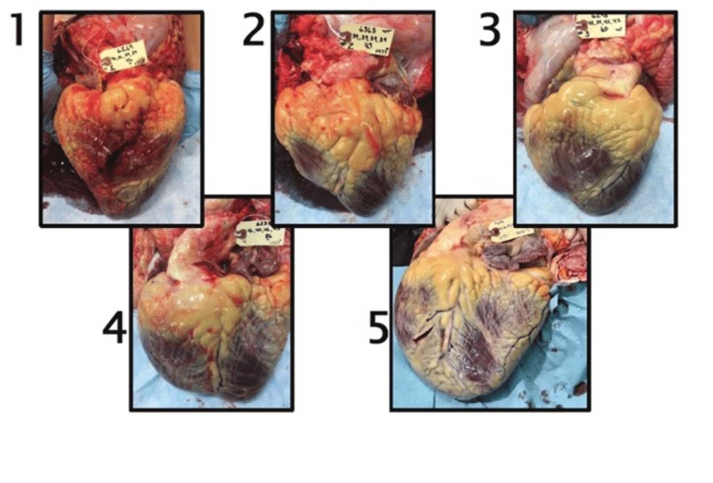 heart graphic